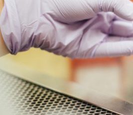 Why We Prefer Sanitary Sewer Over Septic Systems